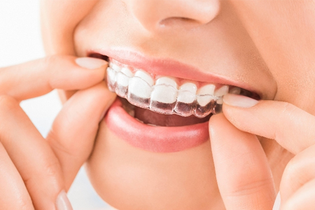 best dentist in Agra 