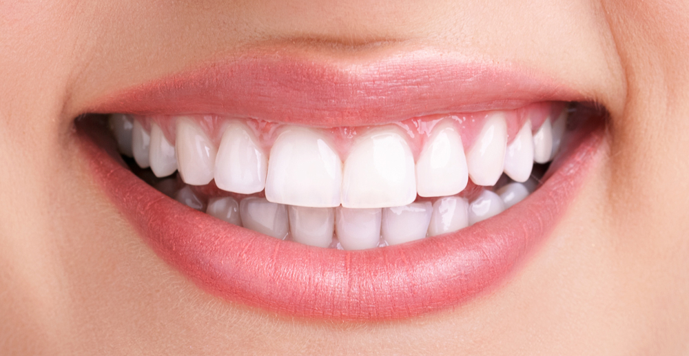 teeth whitening services in Agra 